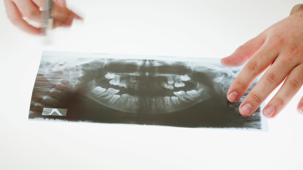 Close-up of a healthcare professional examining a dental panoramic X-ray