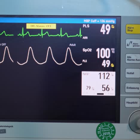 monitor showing the rhythm and heartbeat of a patient during operation. medical equipment necessary for surgeries. working screen close up