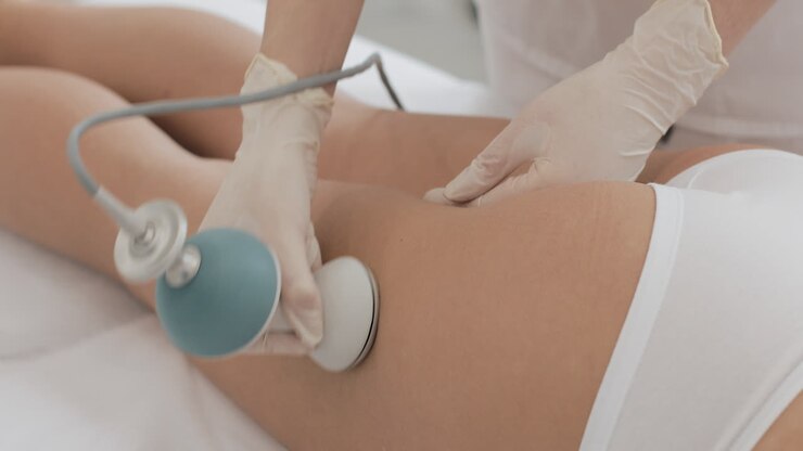 Cellulite treatment procedure on woman's thigh