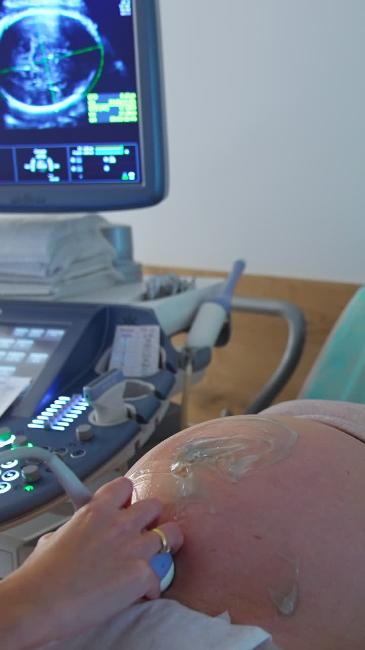Woman with big belly of last months pregnancy is being checked at ultrasound scan. Doctor's hand moves the device around abdomen covered with gel. Vertical video
