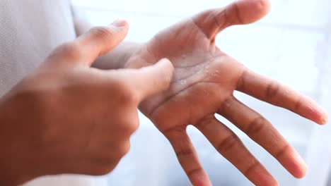 close up of dry cracked skin of a mens hand ,