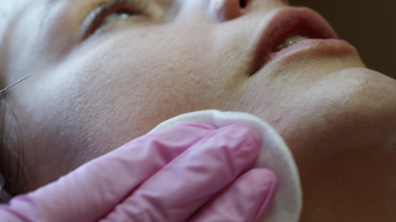 Dermal Filler Injections for Facial Rejuvenation