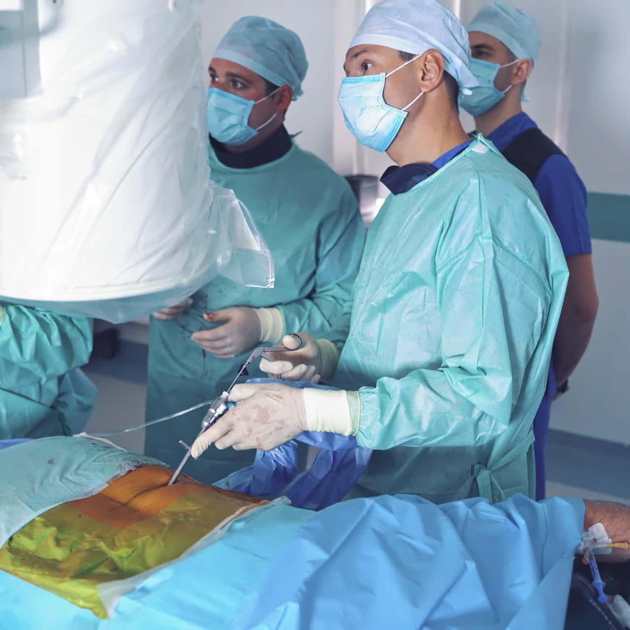 Teamwork of surgeons performing an operation. Surgery room with male specialists in medical uniform doing an operation on patient's back in hospital.