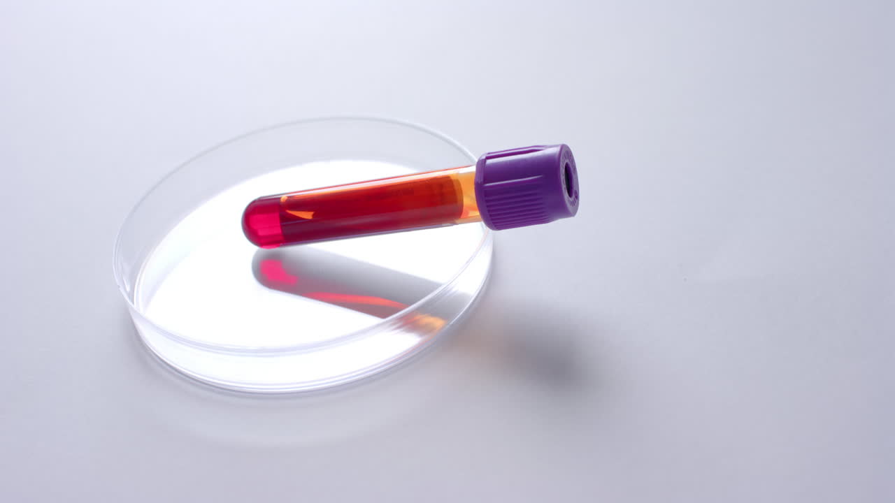 백색 바탕에 있는 혈액  ⁇ 플과 페트리 접시의 클로즈업, 복사 공간, 슬로우 모션