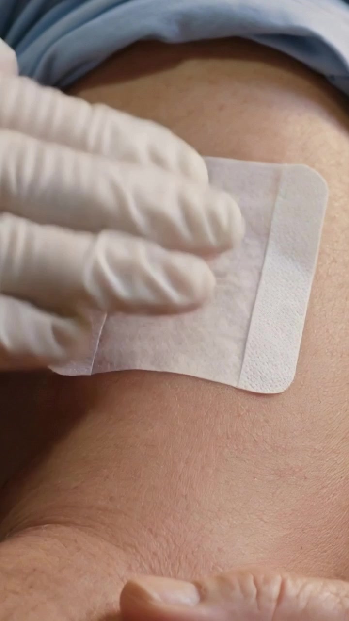 Video verticale: Infermiera guantata che applica un cerotto quadrato sulla parte superiore del braccio, assicurando l'adesione, in clinica.