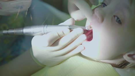 child dental procedure