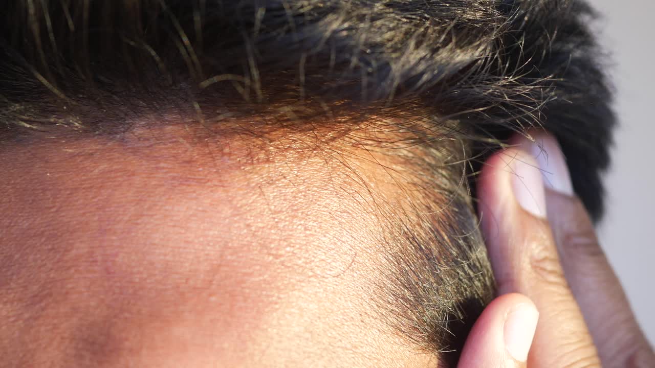 손가락으로 두피를 만지는 남자, 근접