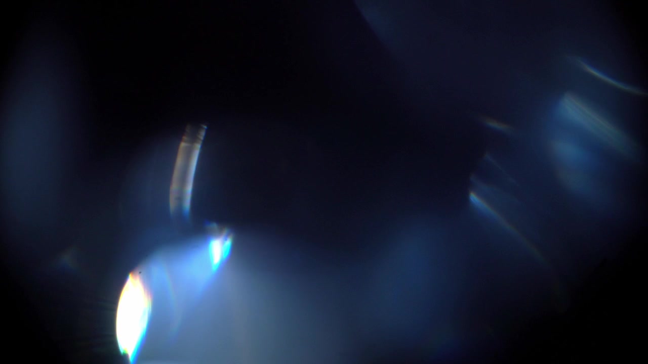 Perdite di luce ottica dinamica e bagliori dell'obiettivo