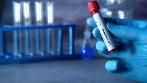 análisis de sangre para el coronavirus en un laboratorio