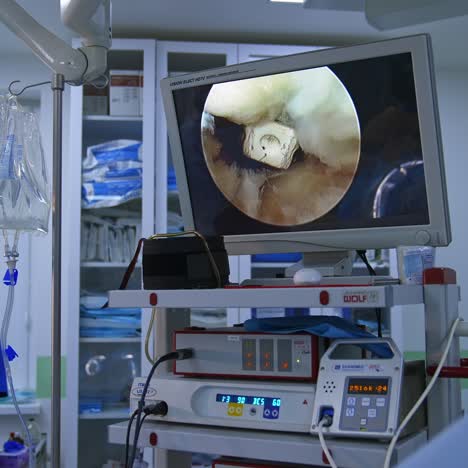 close up of laparoscopic surgery