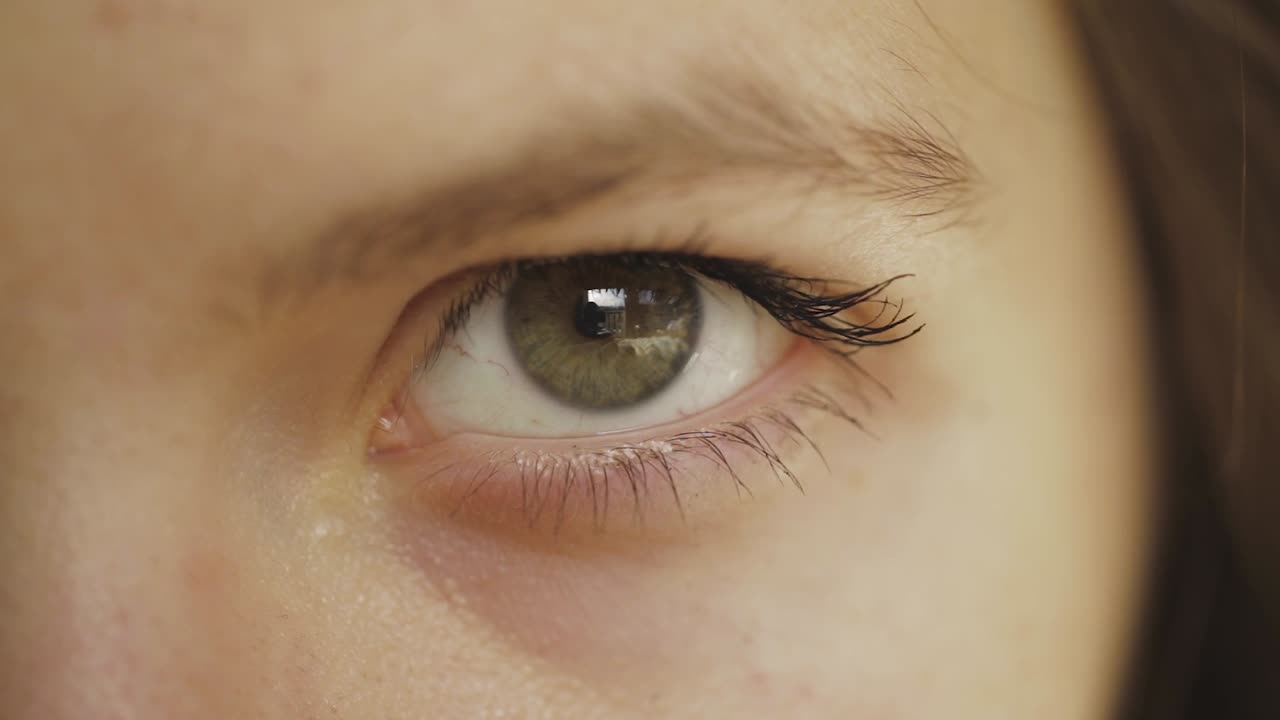 el ojo izquierdo de la niña se cierra herméticamente durante unos segundos y se abre de nuevo - cerrar