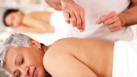 masaje, spa y acupuntura con una mujer madura