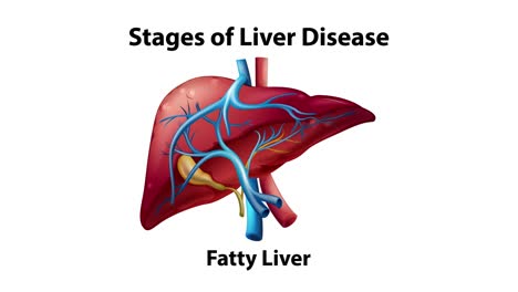 illustrative stages from healthy to cirrhotic liver