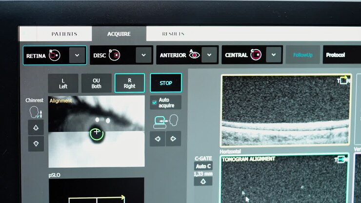 Digital microscope during medical examination. C.lose up of eye test machine in ophthalmology clinic