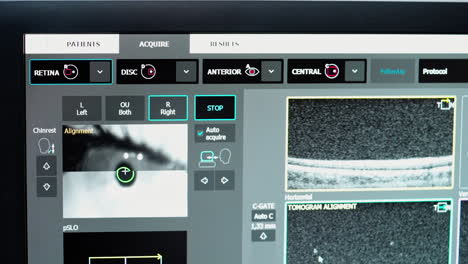 Digital microscope during medical examination. C.lose up of eye test machine in ophthalmology clinic