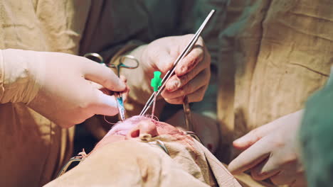 surgery team operating