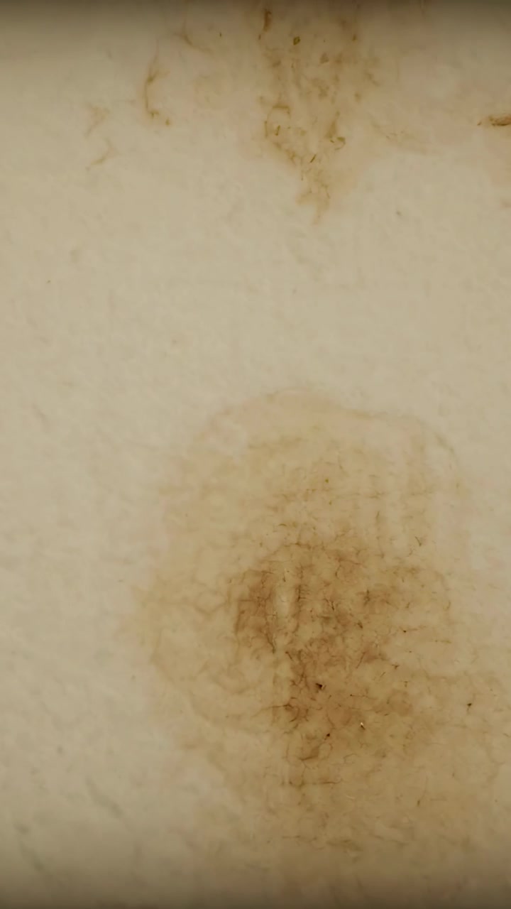 Vertical video: Shifting camera focus showing center brown skin spot and smudge above for detail