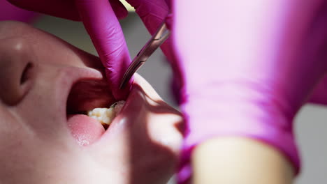installing dental braces on the lower jaw of a girl at the dentist. close-up of hands in rubber gloves with medical tweezers
