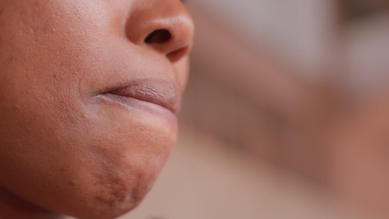 Donna nera all'aperto con labbra secche e screpolate dal vento, sguardo verso l'alto, sfondo di scala urbana, la luce naturale evidenzia la texture della pelle, atmosfera da atleta determinata, grinta e perseveranza in un ritratto spontaneo.