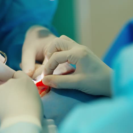 plastic surgery of patient
