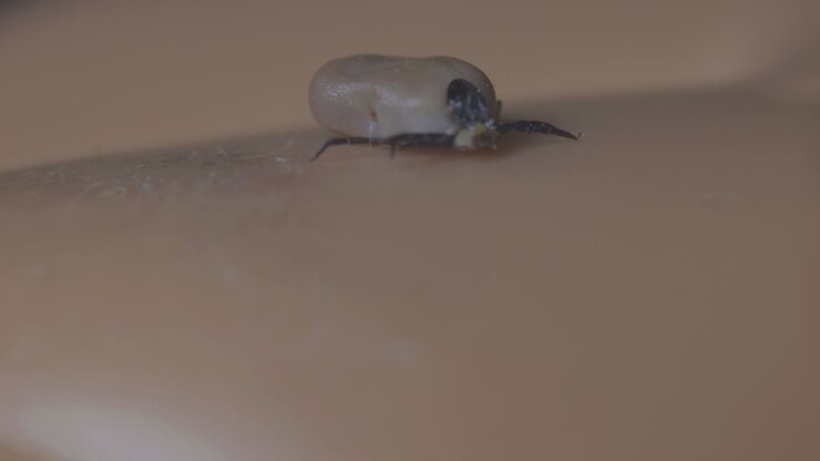 Zecca piena di sangue che striscia sulla pelle di una persona, visione macro ravvicinata estrema.