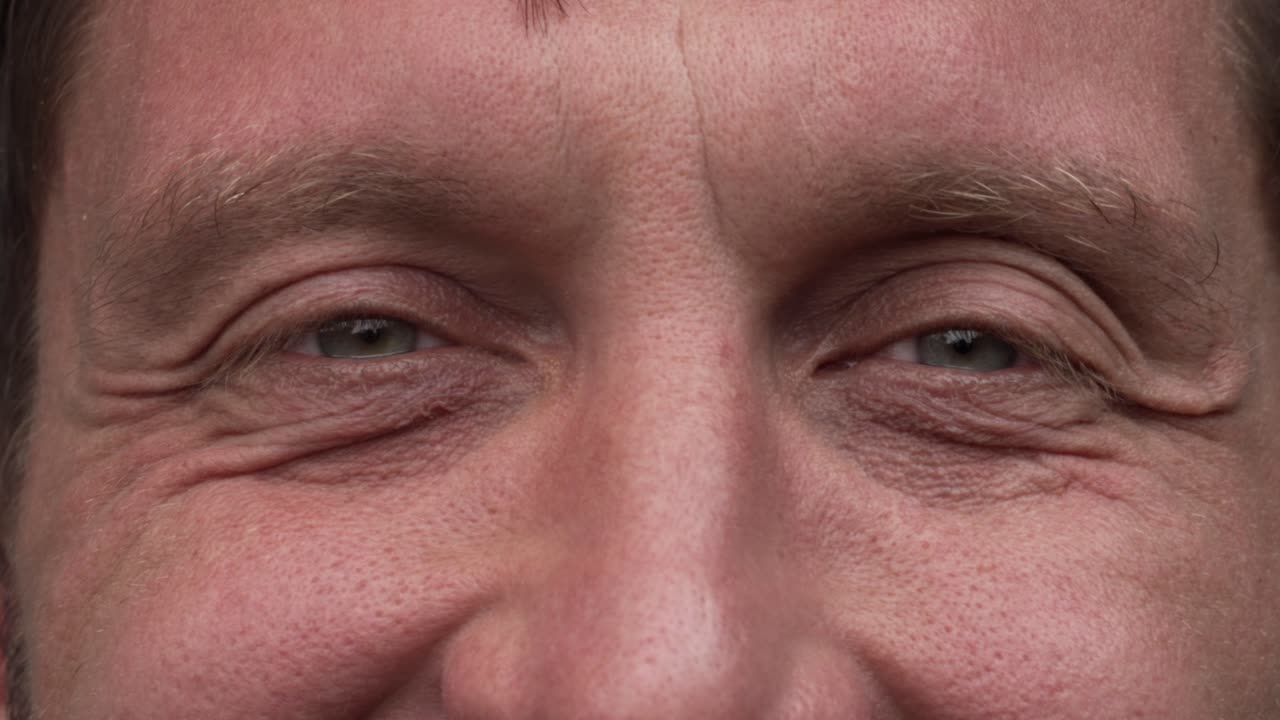 Close-up of a person's eyes with visible wrinkles