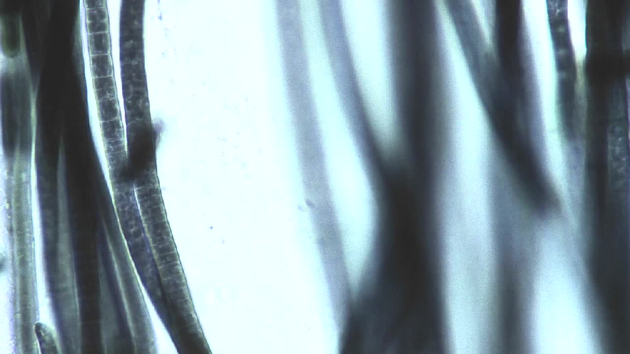 vista microscópica de algas verde azul phormidium