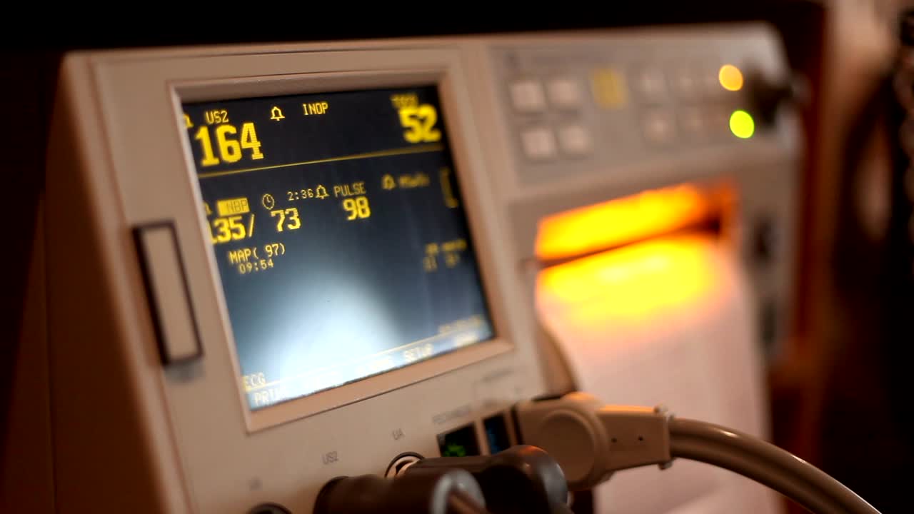 병원 심장 모니터는 현재 분만 중인 임산부 내부의 아기를 모니터링합니다.