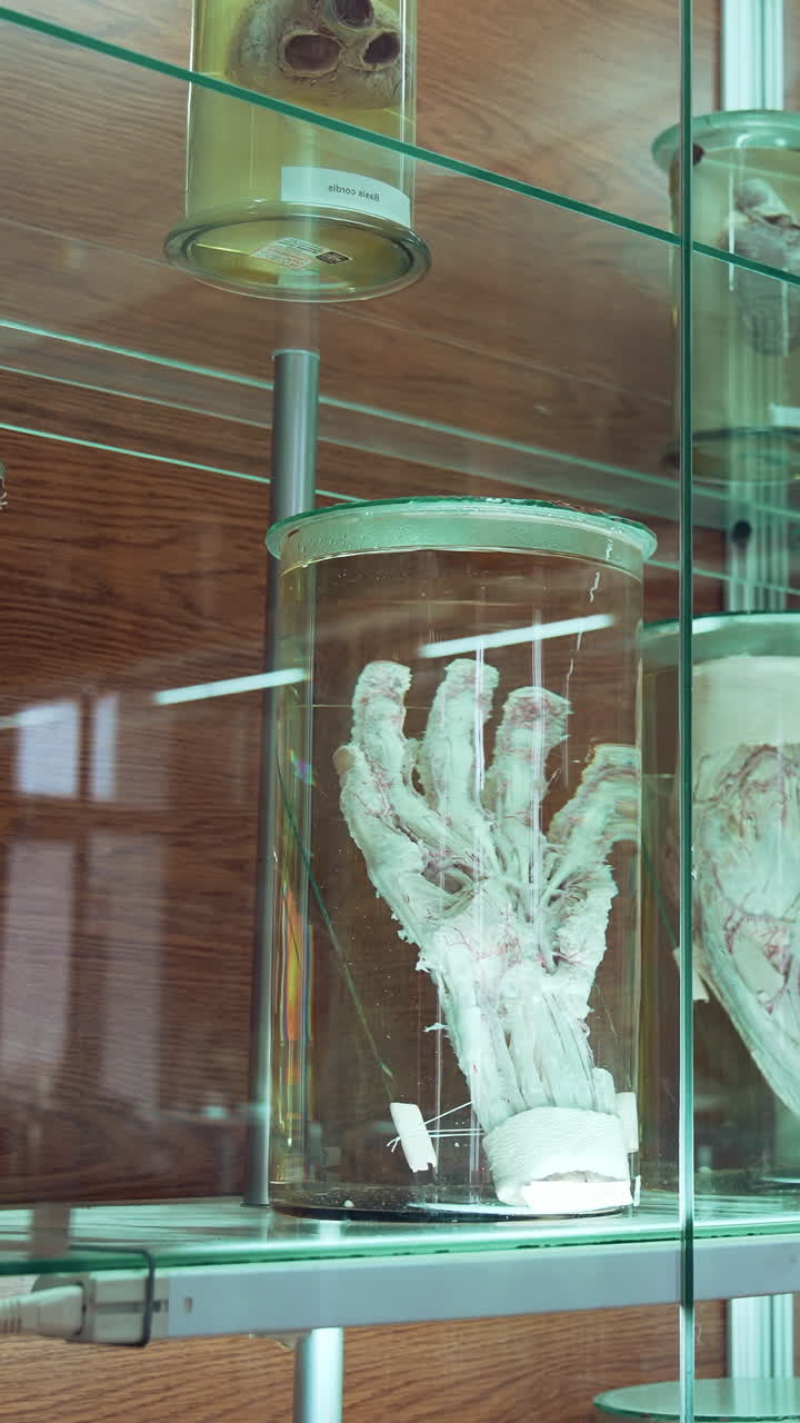 Human organs in museum