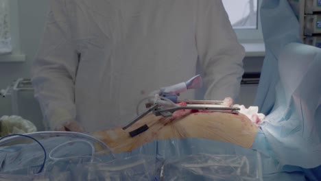 cardiac surgeons perform heart surgery he watered the wound from the syringe