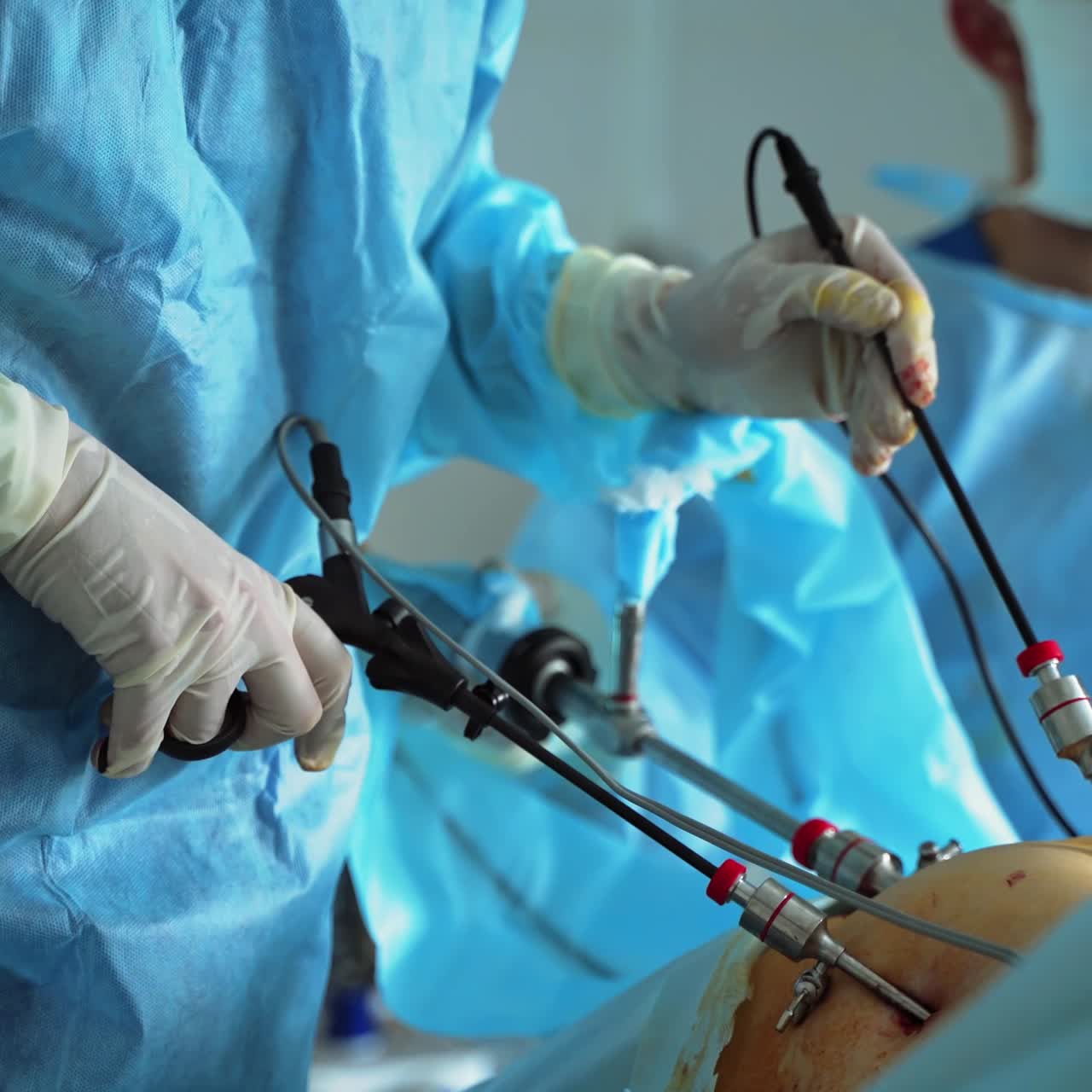 Professional doctors with surgical instruments. Surgeon's hands in sterile gloves work with modern medical tools during surgery. Surgeons doing operation to a patient.