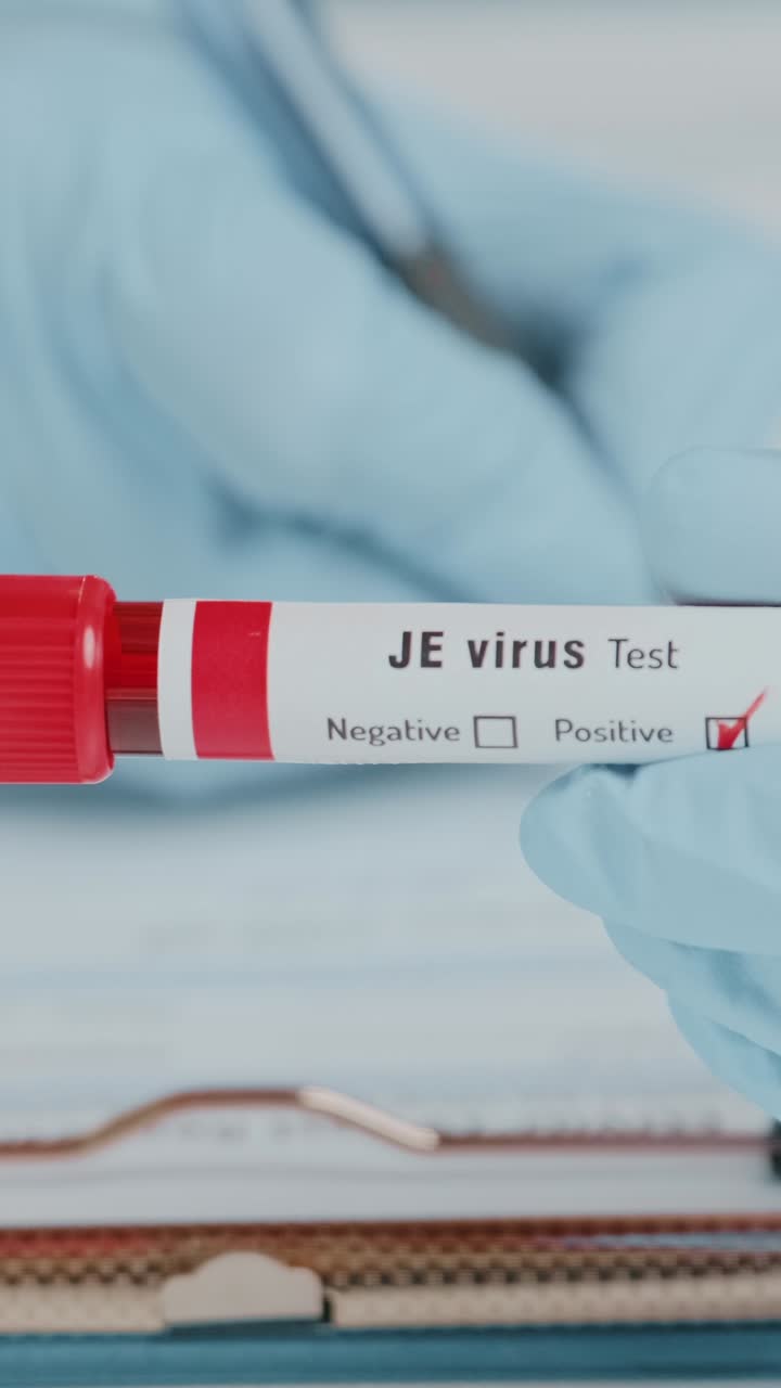 Doctor shows positive blood test for japanese encephalitis virus