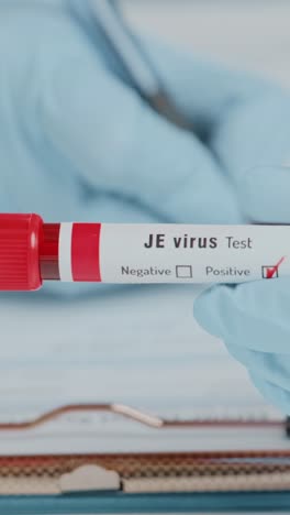 doctor shows positive blood test for japanese encephalitis virus