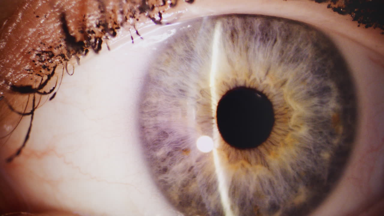 Close-Up of Human Eye During Eye Examination
