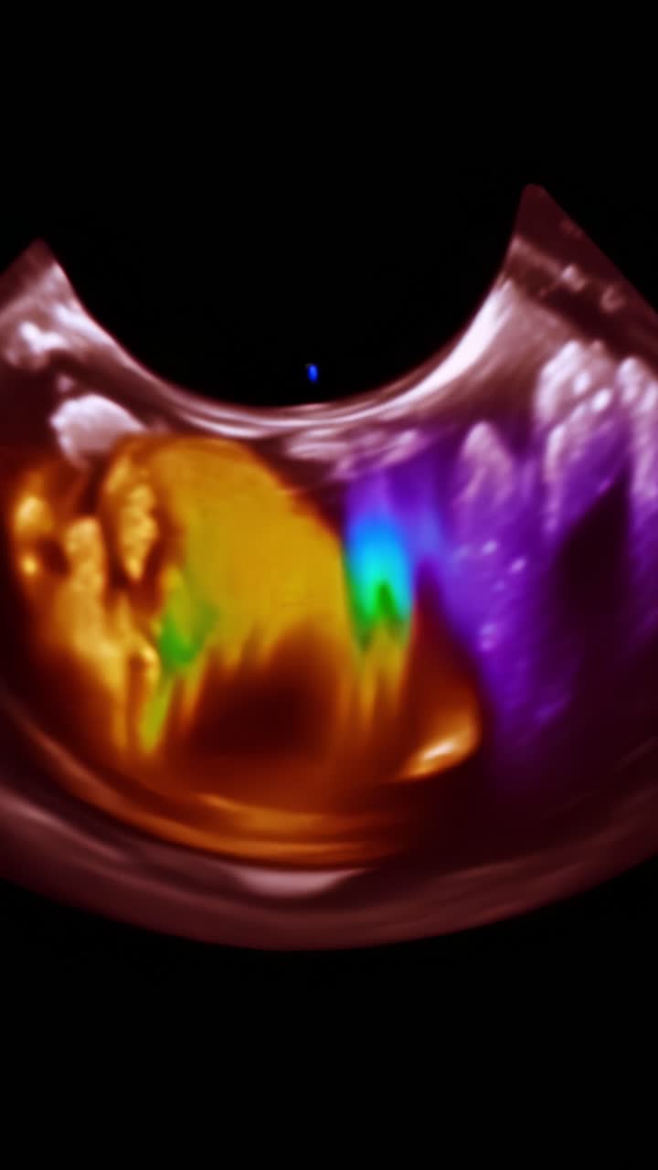 Espectros de ultrassom vibrantes exibindo padrões de cores vívidos de elementos internos em uma perspectiva única da tecnologia de imagem de diagnóstico