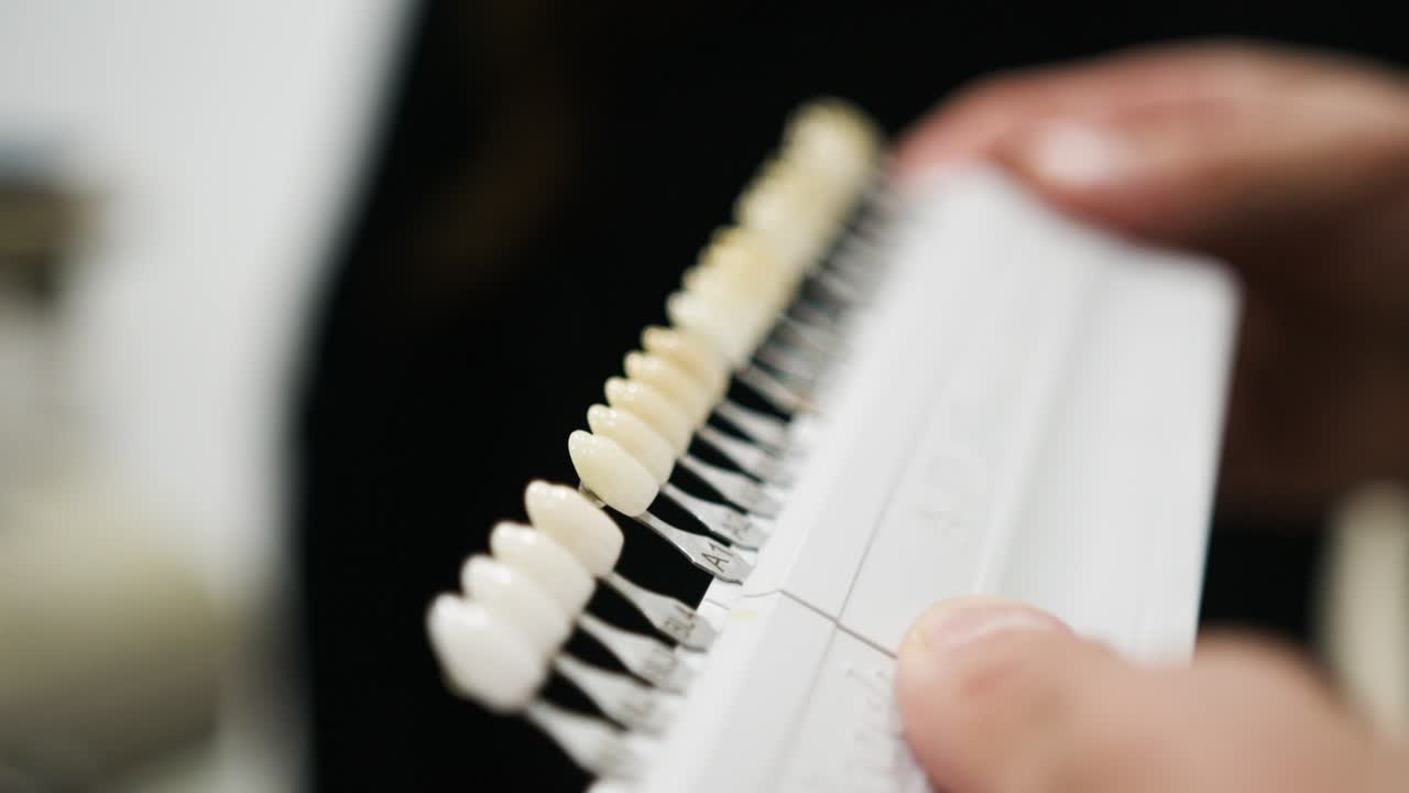 치과의사 는 환자 에게 치아 를 게 하는 색채 차트 를 보여 준다