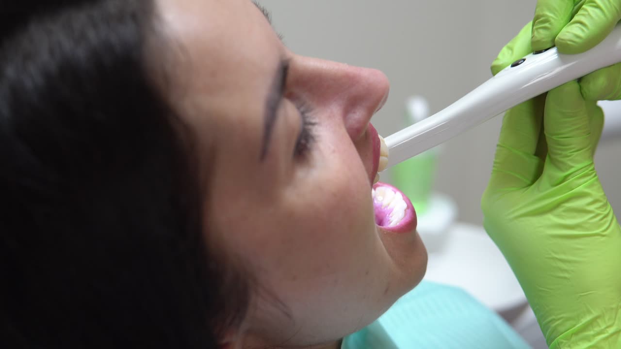 Closeup view of young female dentist examining the mouth of a patient with an intraoral camera and showing image on the screen. Shot in 4k