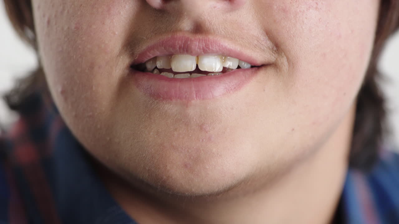 giovane ragazzo adolescente bocca sorridendo da vicino denti