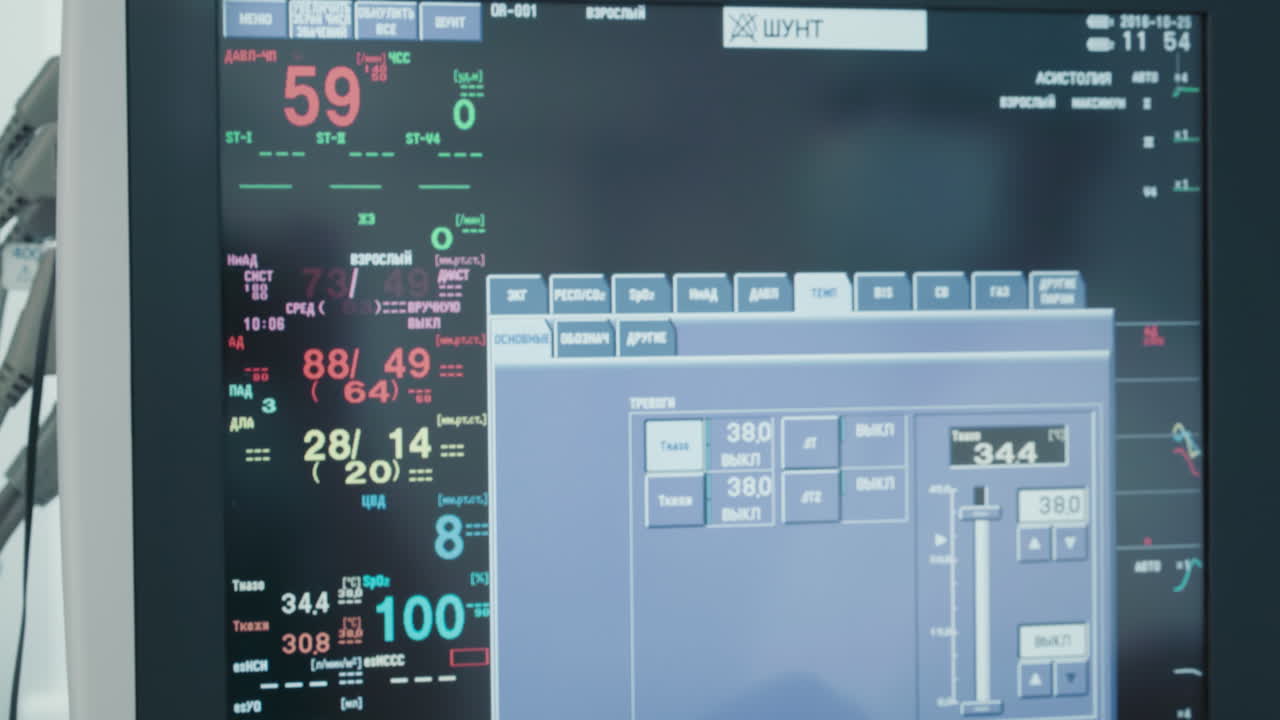 el médico comprueba los indicadores vitales en la pantalla del monitor. el equipo médico proporciona información crucial sobre el estado de salud del paciente durante la cirugía en la clínica