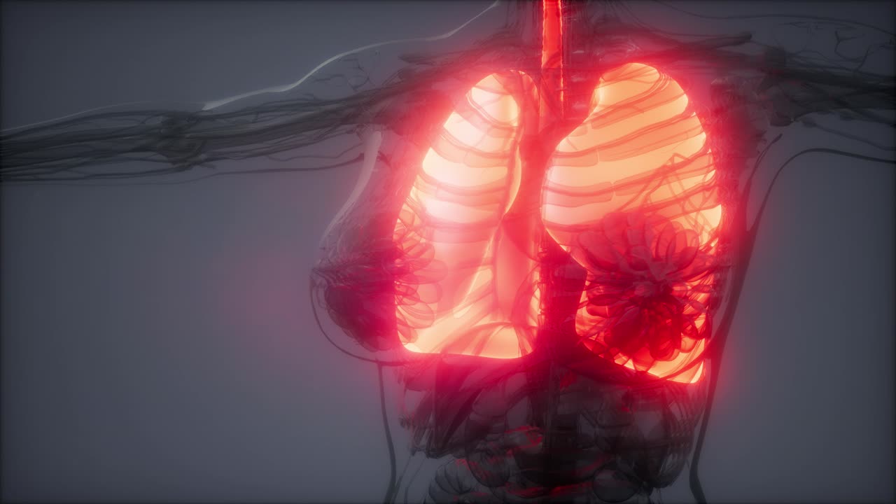 examen radiológico de los pulmones humanos