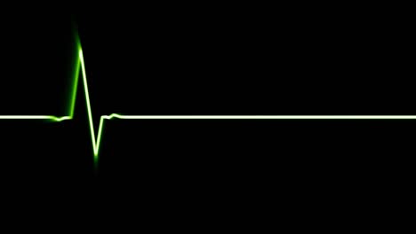 electrocardiograma en el bucle de la línea verde