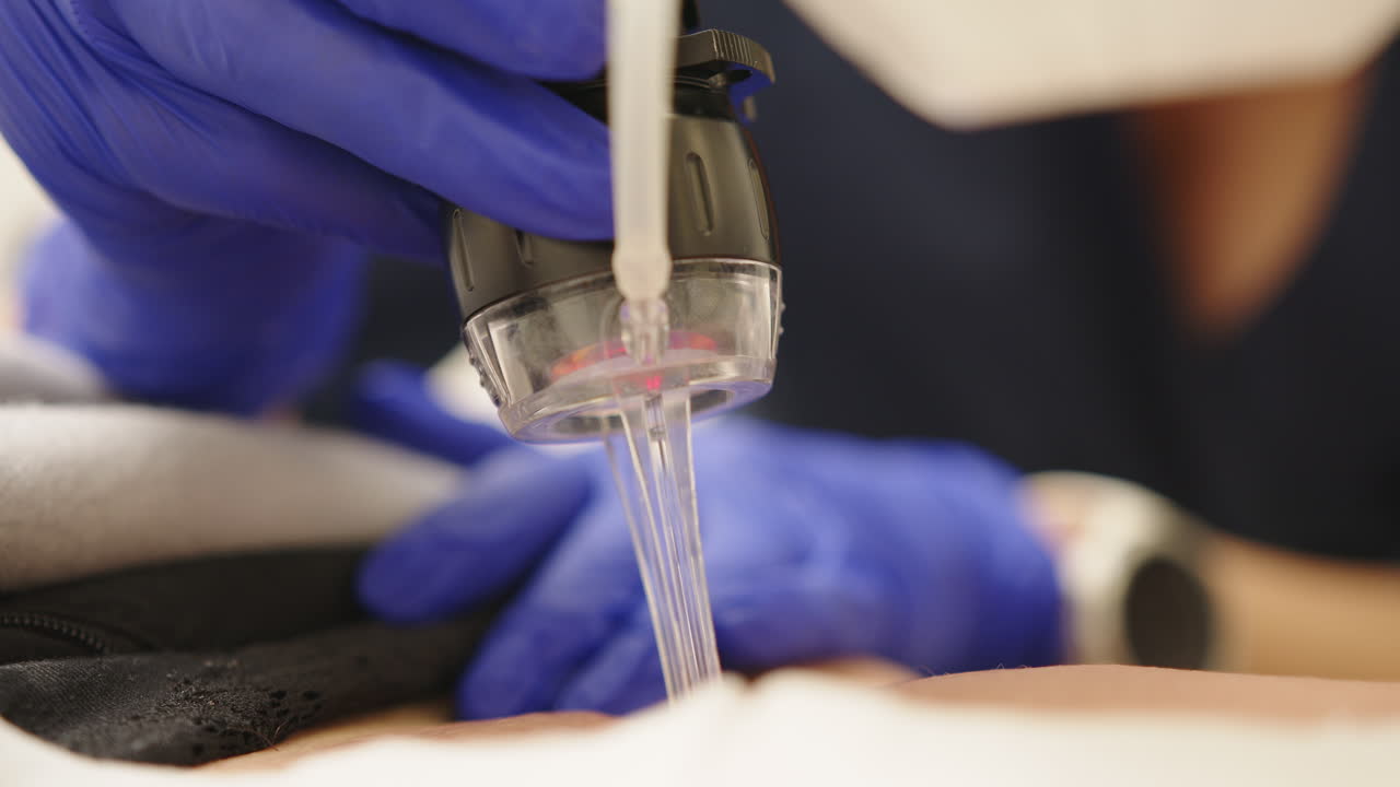 피부 치료 절차