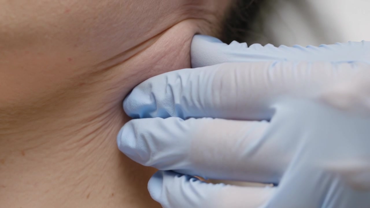 Mano guantata di blu che si avvicina, palpando il lato destro del collo in clinica, premendo e facendo rotolare per valutare il tessuto.