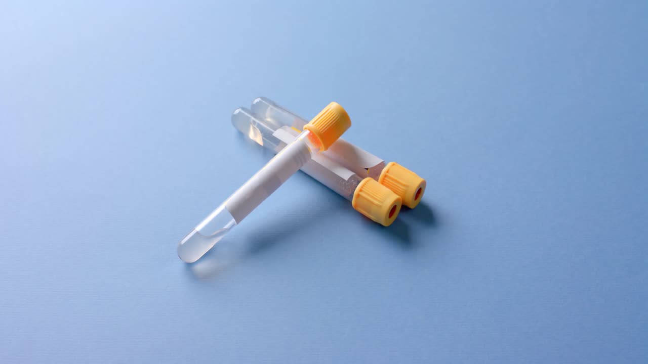 파란색 배경에 있는 혈액  ⁇ 플의 클로즈업, 복사 공간, 슬로우 모션