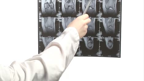 examining an xray