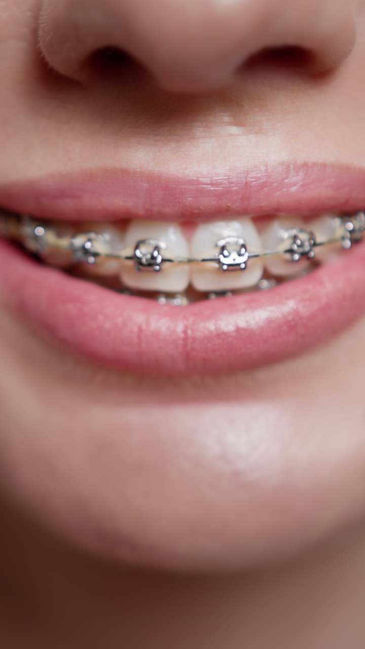Woman with Braces