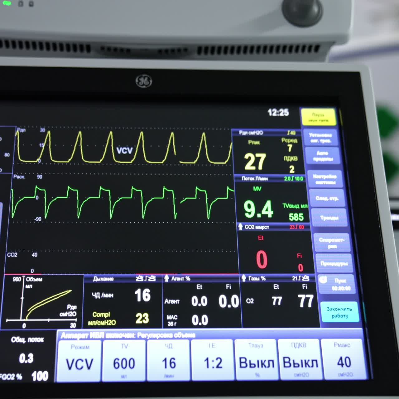 The variety of parameters and figures on the black screen of lung ventilation machine. Close up. Surgery room equipment