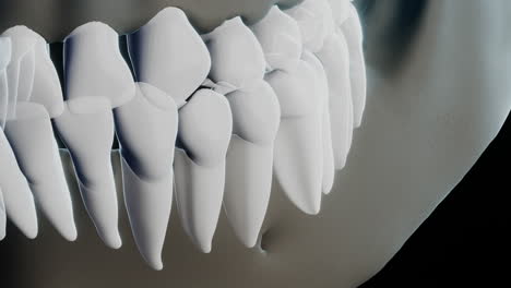Bad-molar-tooth-in-skeleton-on-black-background