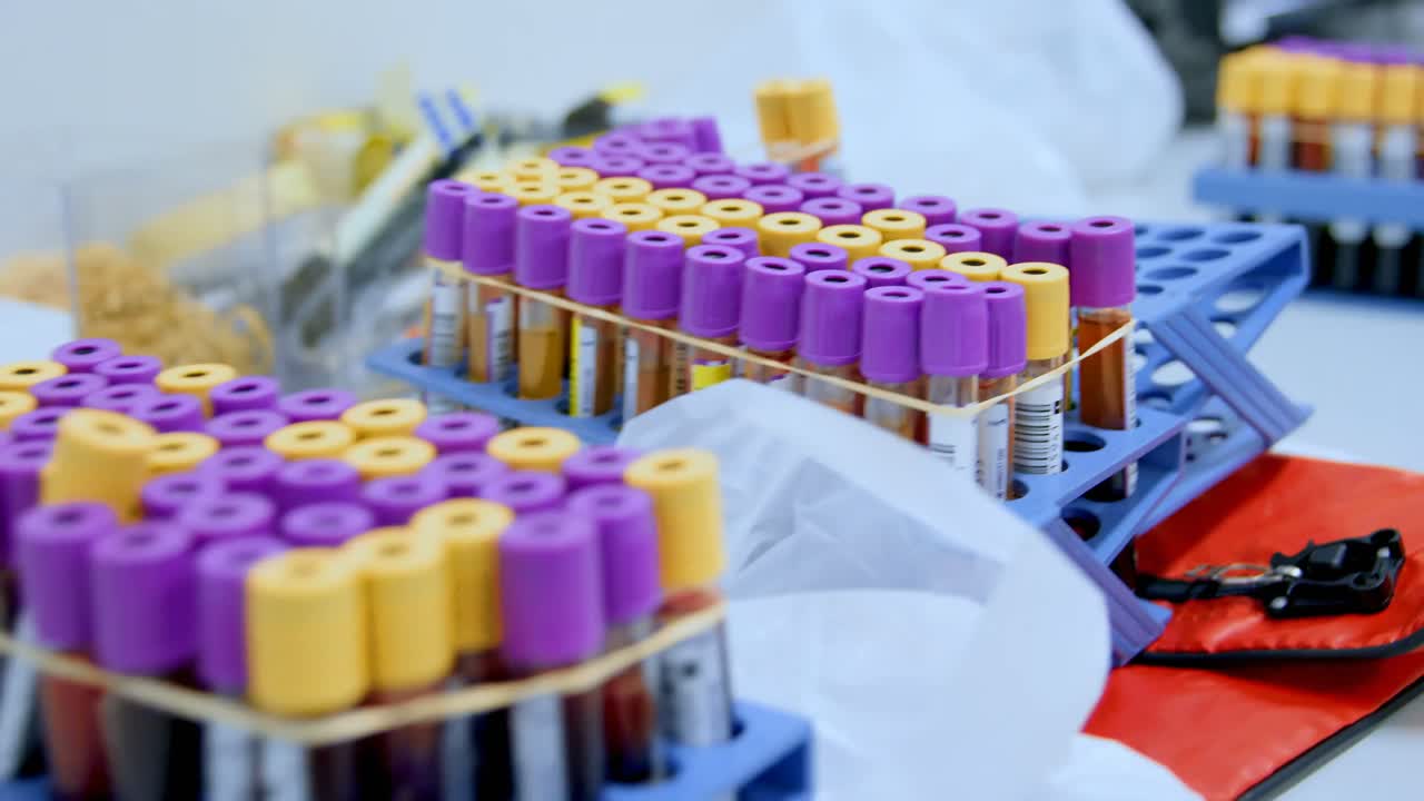 Blood samples in a rack in blood bank 4k