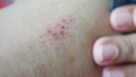 young women suffering from itching skin